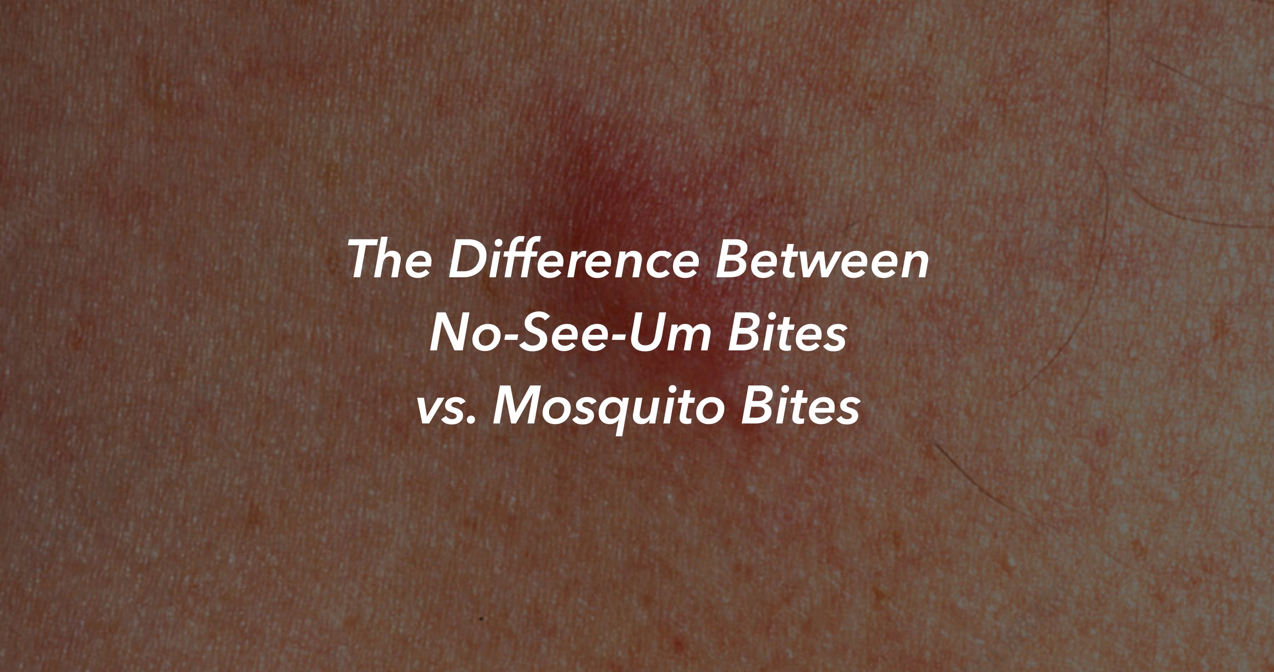 the-difference-between-no-see-um-bites-vs-mosquito-bites-the